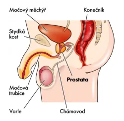 Popis prostaty